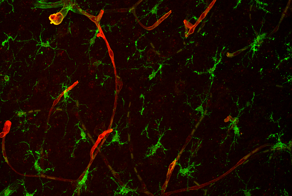 Microscopy showing brain tissue cells.