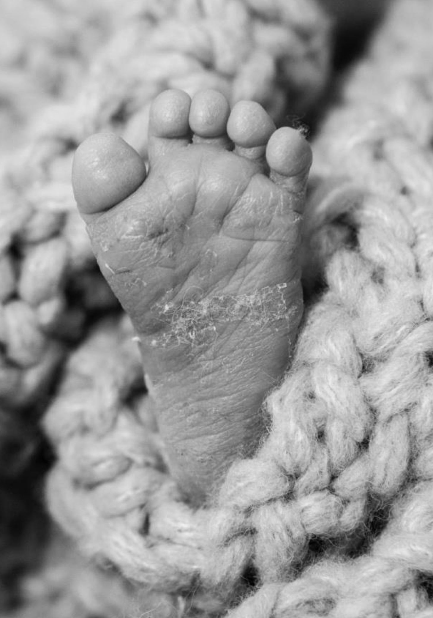 Infant's foot