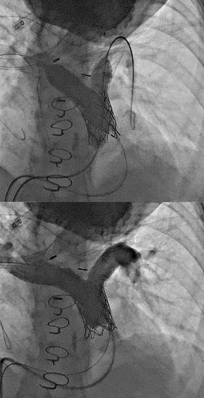 Case Example - cardiology Case Example - cardiology