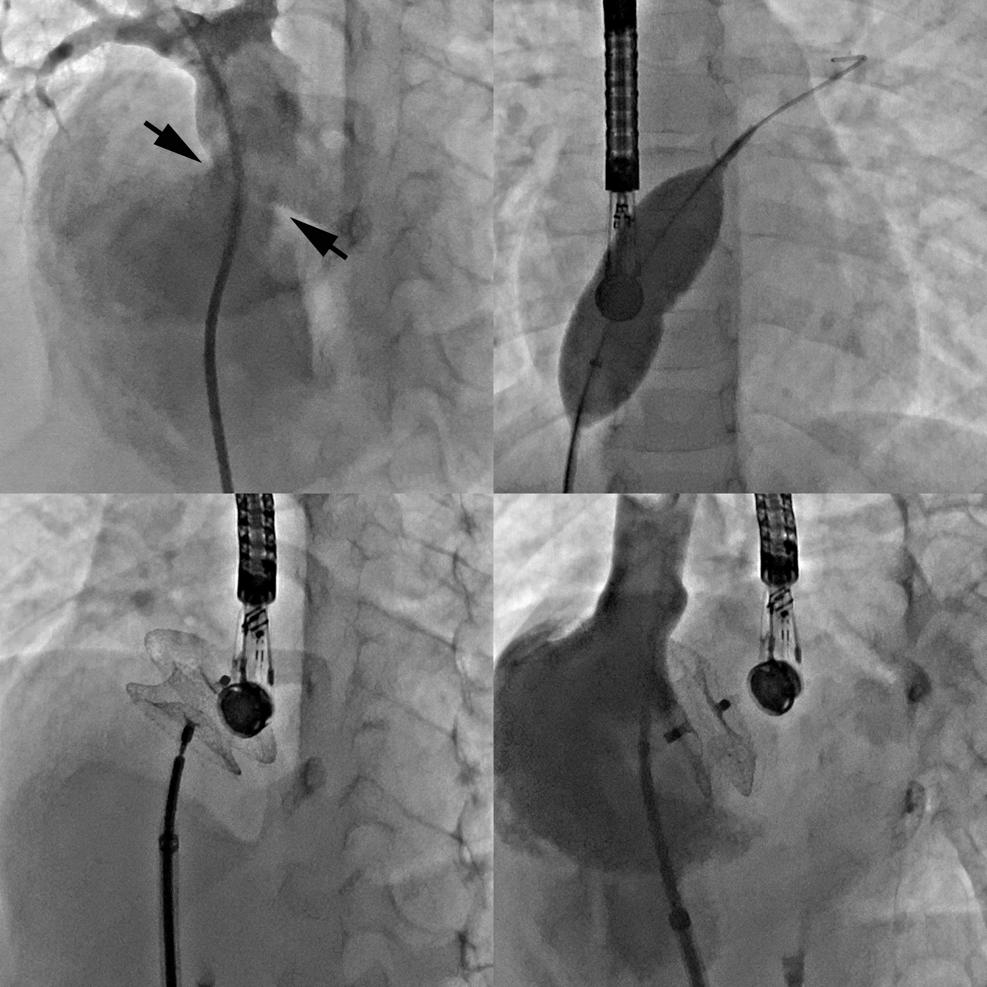 Cardiac Catheterization Program Pediatrics 8366