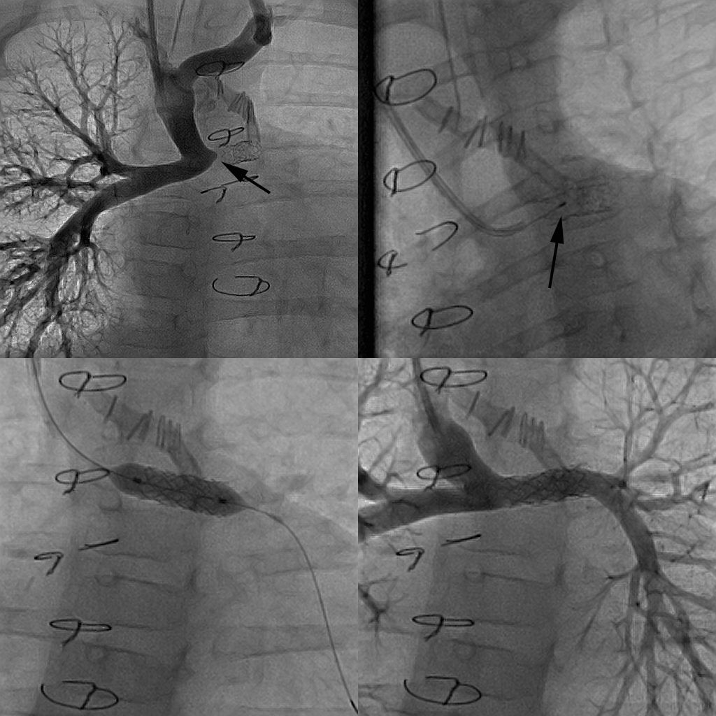 Cardiology Case - Cardiology Case -